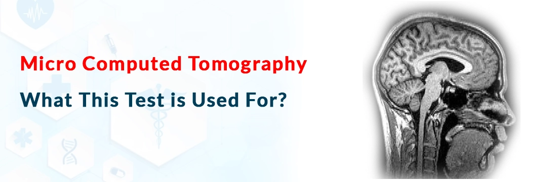 Micro Computed Tomography: What This Test is Used For?